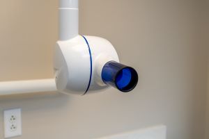 A picture of a digital x-ray machine.