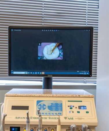 An image of a computer screen showing a close-up of a tooth. Below the screen is an array of endodontic tools.